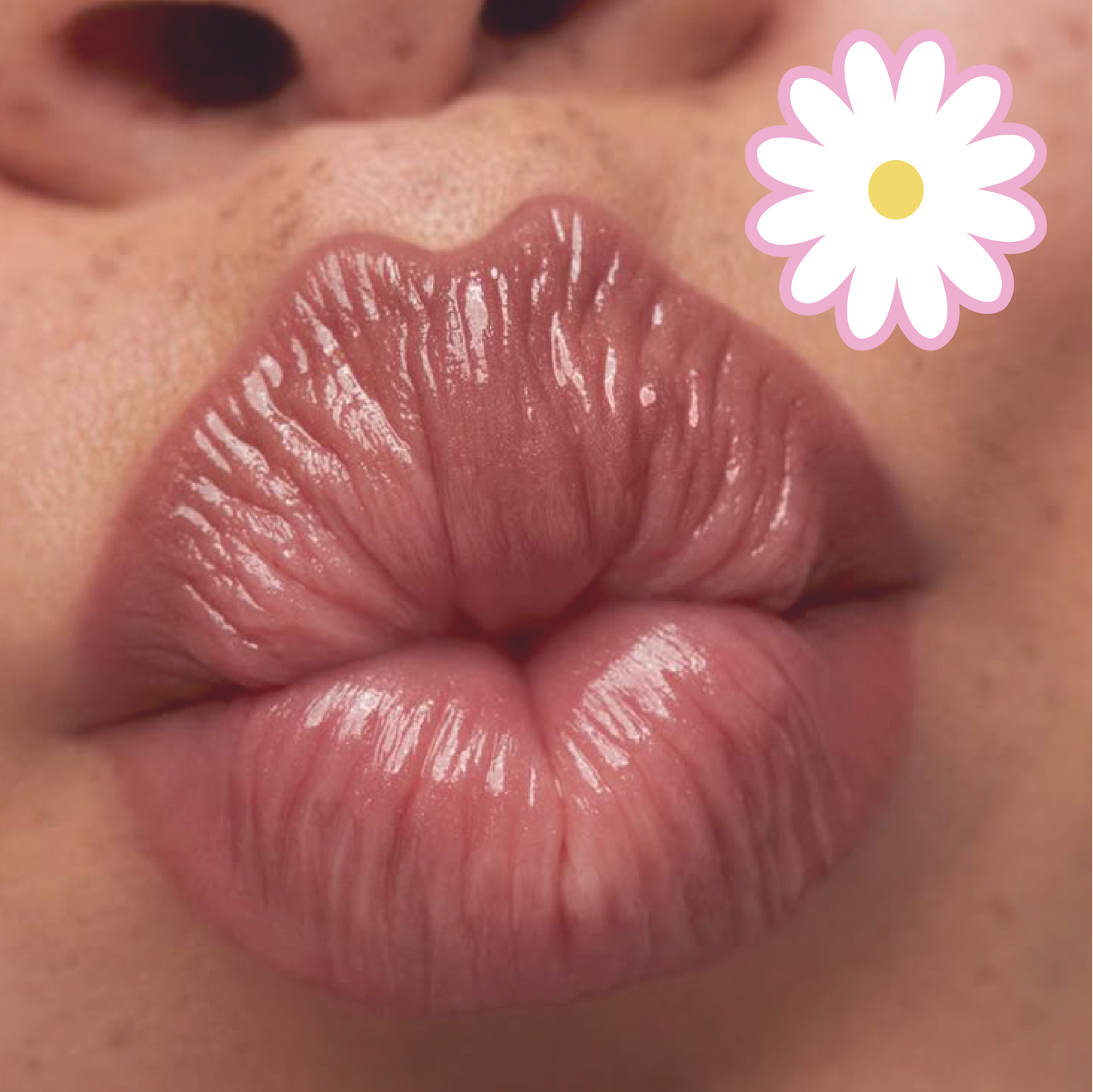 LABIOS